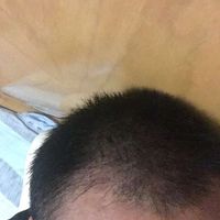 發(fā)際線用戶圖片
