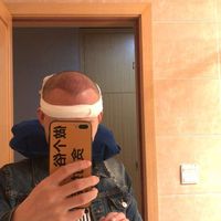 發(fā)際線用戶圖片