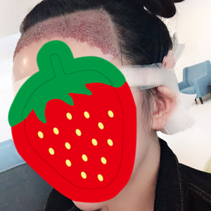 发际线分享社区