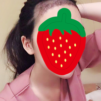 發(fā)際線用戶圖片