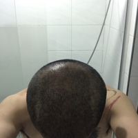 發(fā)際線用戶圖片