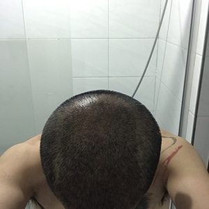 发际线分享社区