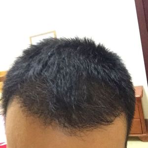 发际线分享社区