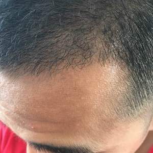 发际线分享社区