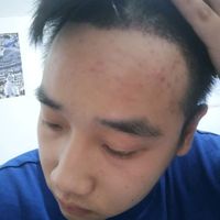 發(fā)際線用戶圖片