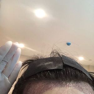 发际线分享社区