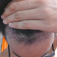發(fā)際線(xiàn)用戶(hù)圖片