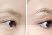 做眉毛种植术前术后注意事项有哪些？下面这些你不得不注意了