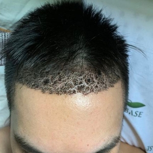 发际线分享社区