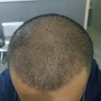 發(fā)際線用戶圖片