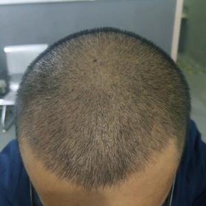 发际线分享社区