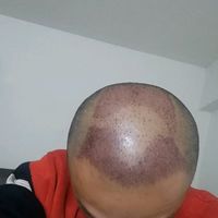 禿頂用戶圖片