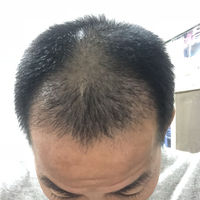 發(fā)際線用戶圖片