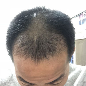 发际线分享社区