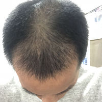 發(fā)際線用戶圖片