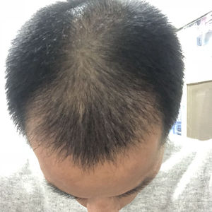 发际线分享社区