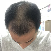 發(fā)際線用戶圖片