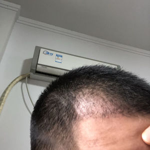 发际线分享社区