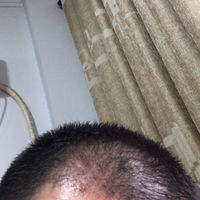 發(fā)際線用戶圖片