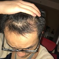 發(fā)際線用戶圖片