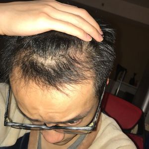 发际线分享社区