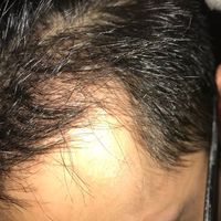 發(fā)際線用戶圖片