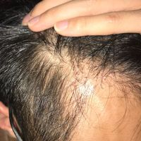 發(fā)際線用戶圖片