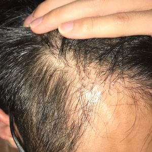 发际线分享社区