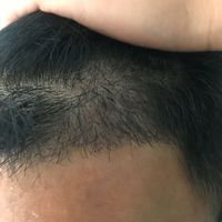 發(fā)際線用戶圖片