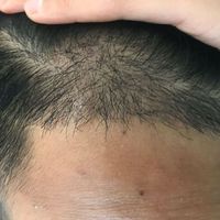 發(fā)際線用戶圖片