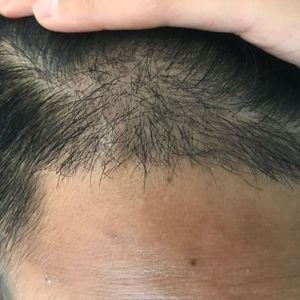 发际线分享社区
