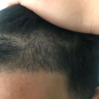 發(fā)際線用戶圖片