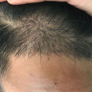 发际线分享社区