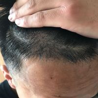 發(fā)際線用戶圖片