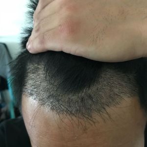 发际线分享社区