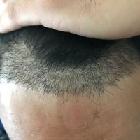 發(fā)際線用戶圖片