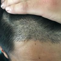 發(fā)際線用戶圖片