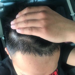 发际线分享社区