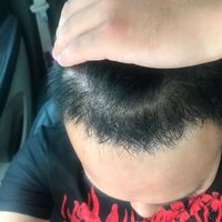 發(fā)際線用戶圖片