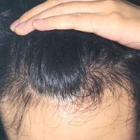 發(fā)際線用戶圖片