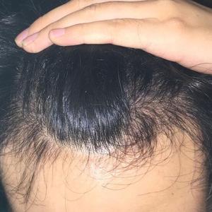 发际线分享社区