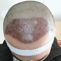 發(fā)際線用戶圖片