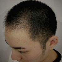 發(fā)際線用戶圖片