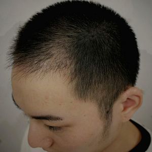 发际线分享社区