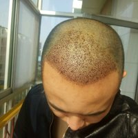 發(fā)際線用戶圖片