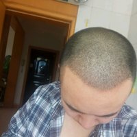 發(fā)際線用戶圖片