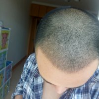發(fā)際線用戶圖片