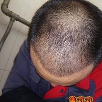 發(fā)際線用戶圖片