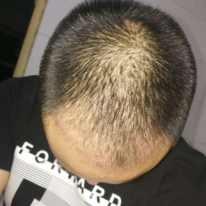 发际线分享社区