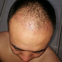 發(fā)際線用戶圖片
